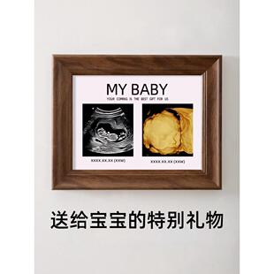 宝宝四维照片相框孕期产检彩超nt打印婴儿b超mybaby相册定制摆台
