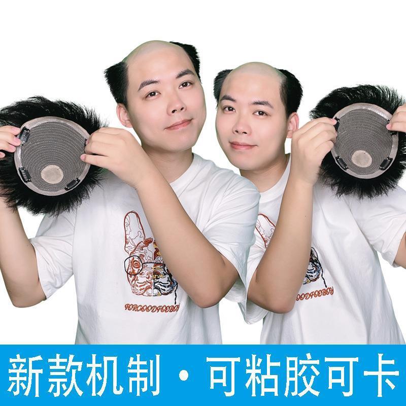 真发补发片男补发块机制可黏胶卡子新款网红假发中分浏海短发自然