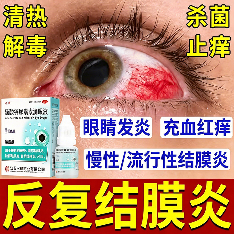 治疗结膜炎的眼药水过敏性慢性结膜炎滴眼液抗菌消炎结膜炎专用药