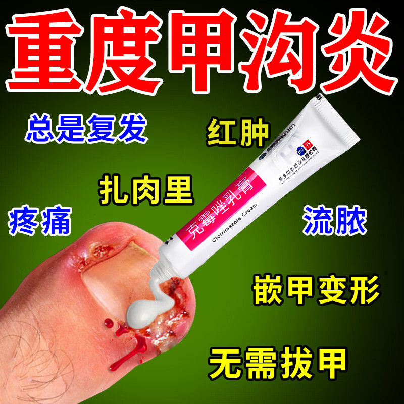 【恒久远】克霉唑乳膏1%*10g*1支/盒