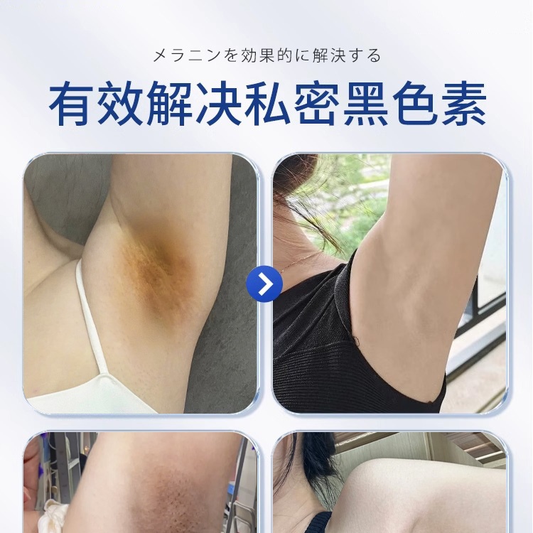腋下去黑美白腋窝祛除黑色素沉淀淡化大腿内侧黑脖子沉着的磨砂膏