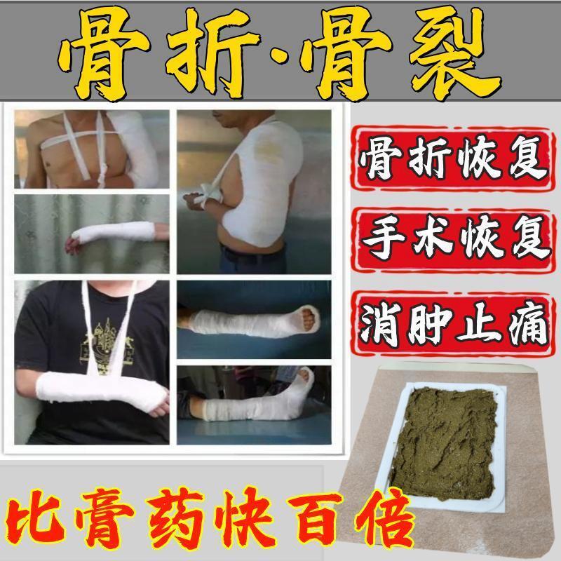 骨裂膏药恢覆药接骨续筋活血化瘀跌打损伤崴脚踝陈旧老伤骨伤愈合