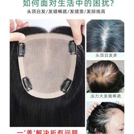 全真发头顶全递针补发片女真人发丝遮白发女长发一片式无痕补发块