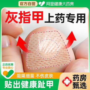 灰指甲保护套脚趾甲遮丑贴上药抹药包甲套胶布专遮挡灰指甲用神器