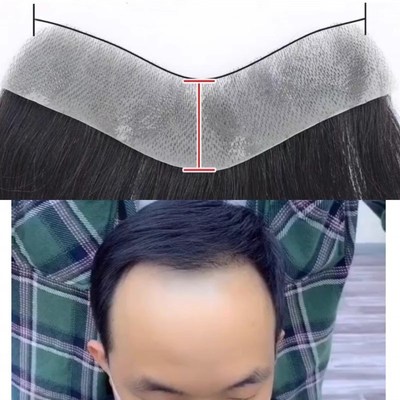发际线假发贴男真发m型r额头自然轻薄补发片假发男士前额假刘海片