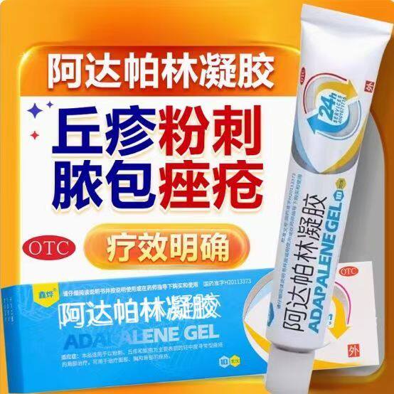 寻常痤疮粉刺脓疱 丘疹面部胸背 皮肤外用凝胶 鑫烨阿达帕林凝胶
