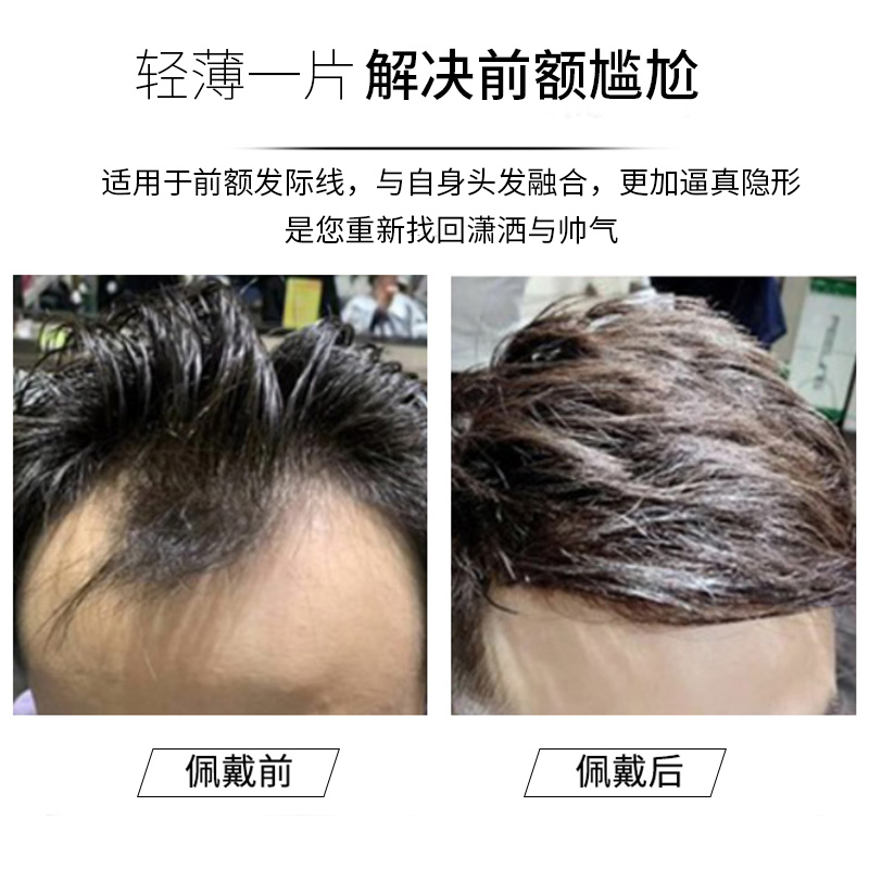 发际线假发贴男士假发片隐形无痕自然真发M型前额补发片刘海片男