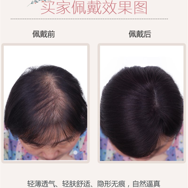 头顶补发片真发发顶隐形无痕补发块遮盖白发递针假发片短发假发女