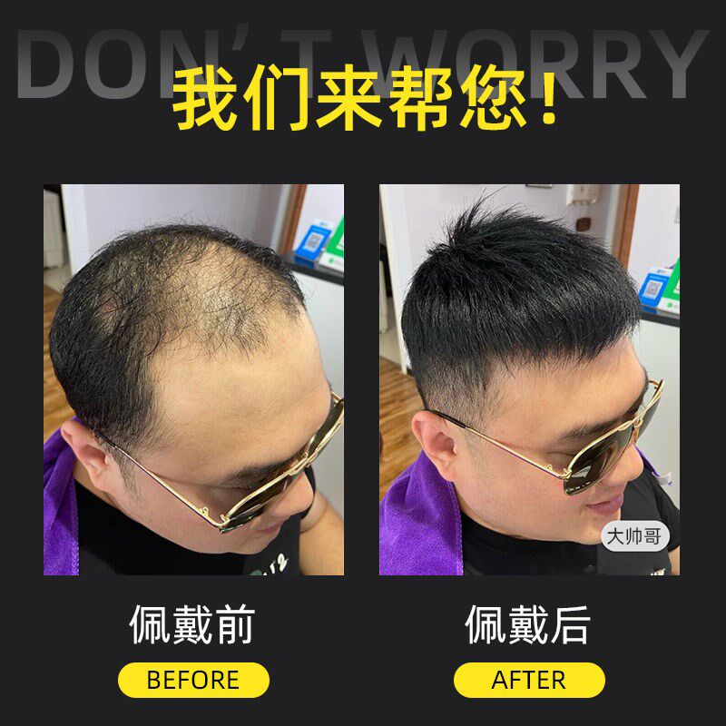 男士假发真发头顶无痕补发片透气自然遮白发秃顶全手工递针假发男