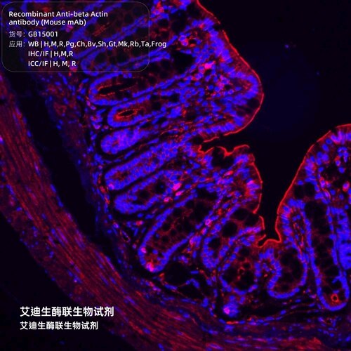 胞质肌动蛋白1,Recombinant Anti-beta Actin antibody,Mouse mAb
