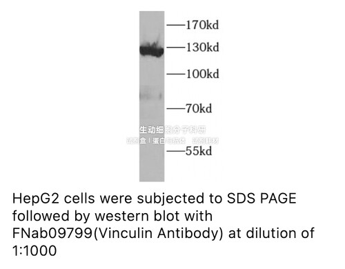 FineTest内参抗体 未标记一抗 VCL-抗体antibody适用ELISA,IHC,WB