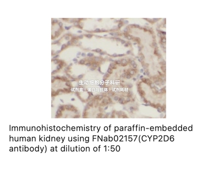 FineTest 未标记一抗 CYP2D6 antibody 抗体，适用ELISA, IHC, WB