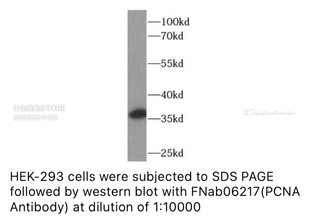 FineTest内参抗体 未标记一抗 PCNA-抗体,适用ELISA,WB,IHC,FC,IP