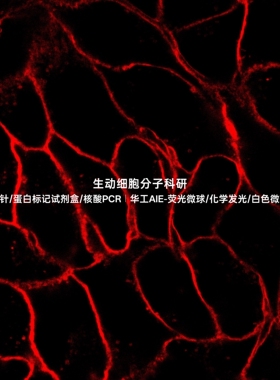 AIE细胞膜红色探针，适用悬浮/贴壁活细胞染色，标记醛类固定细胞