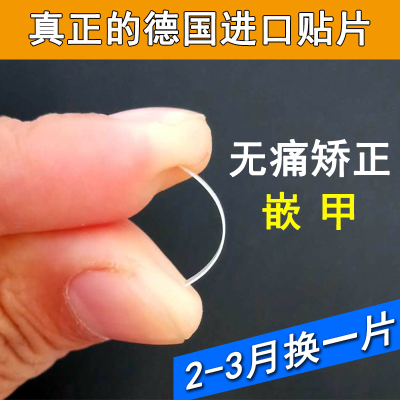 德国嵌甲矫正贴甲沟焱炎拉力贴正甲贴甲面小扎肉疼嵌脚刀修脚店同,家庭/个人清洁工具,美甲/修甲套装,淘宝优惠券,粉丝福利购,淘宝优惠卷