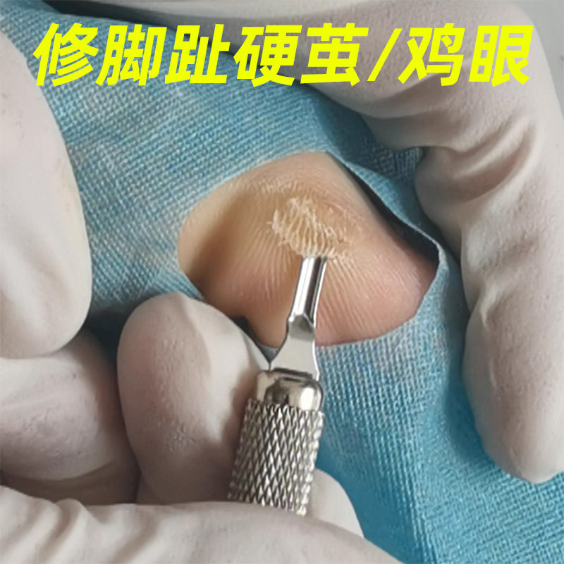 德国修鸡眼刀修脚刀进口鸡眼贴鸡眼膏脚趾老茧硬茧肉刺无痛去鸡眼