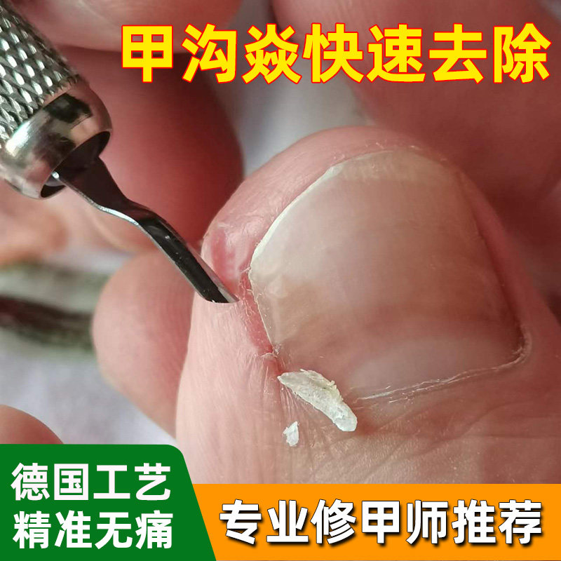 云格森甲沟扎肉疼修甲刀修的彻底