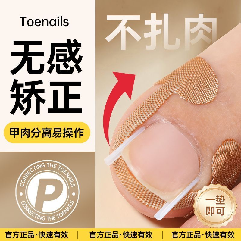 脚趾甲嵌甲矫正隔离贴
