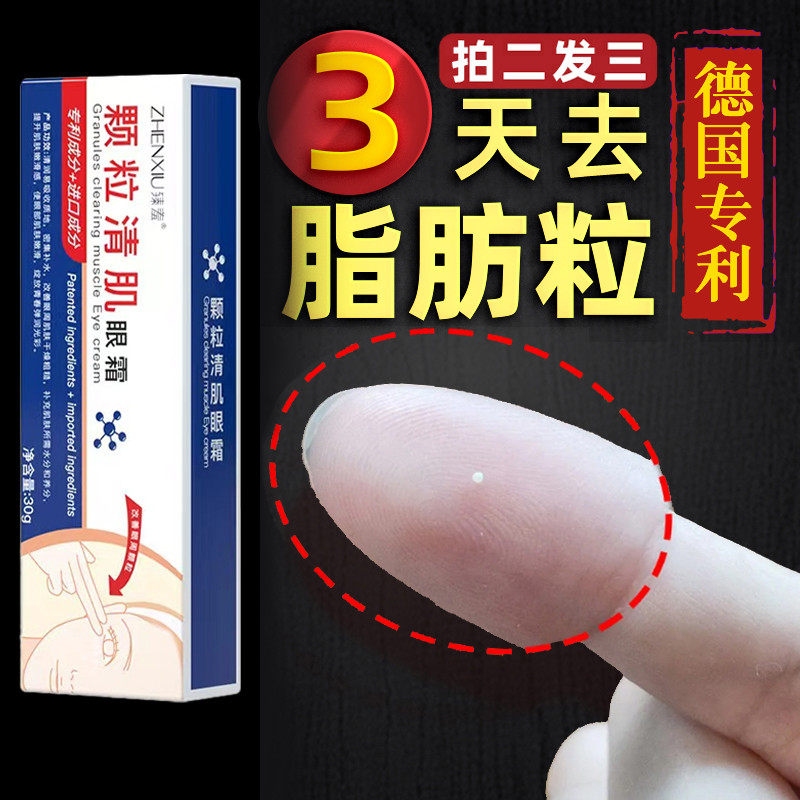 德国脂肪粒去除神器汗管粒眼部祛除油脂扁平颗粒清肌润眼霜黑眼圈