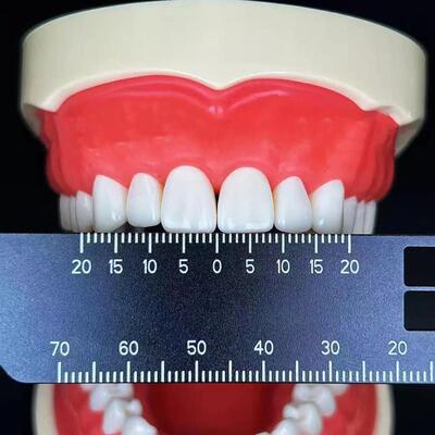 牙间距多功能测量尺牙科器材牙科测量工具口腔牙科T尺HCH画线拍牙