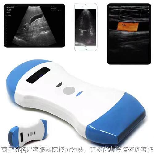 智能无线探头一体B超机猪用三合一羊牛用b超测孕仪器母猪兽用设备