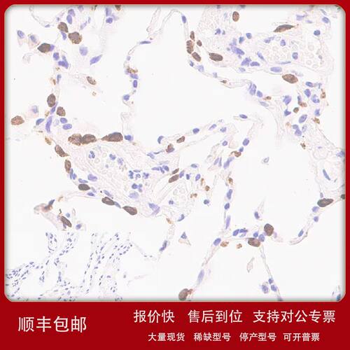 ab312850-40ul abcam 重组Anti-Prosurfactant蛋白C抗体 40ul议价