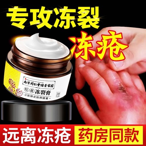 冻疮膏止痒冻伤膏防裂冻耳朵脸部