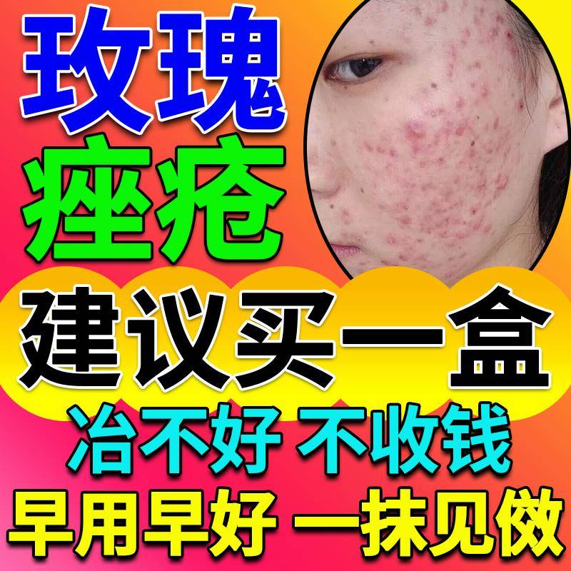 玫瑰痤疮药特效屏障修复专用祛痘印重度暗疮膏闭口粉刺修护舒缓霜