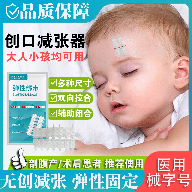 皮肤伤口减张器医用剖腹产儿童伤口愈合疤痕贴拉链式免缝合减张贴