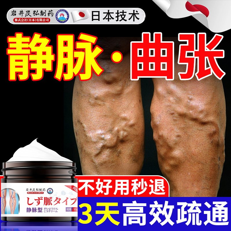 日本静脉曲张专用膏蚯蚓腿青筋凸起红血丝否特效冷敷凝胶官方正品
