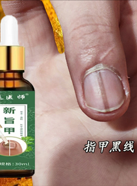 指甲黑色竖纹黑线甲母痣手指真菌表面感染指甲盖凹凸不平护理修复