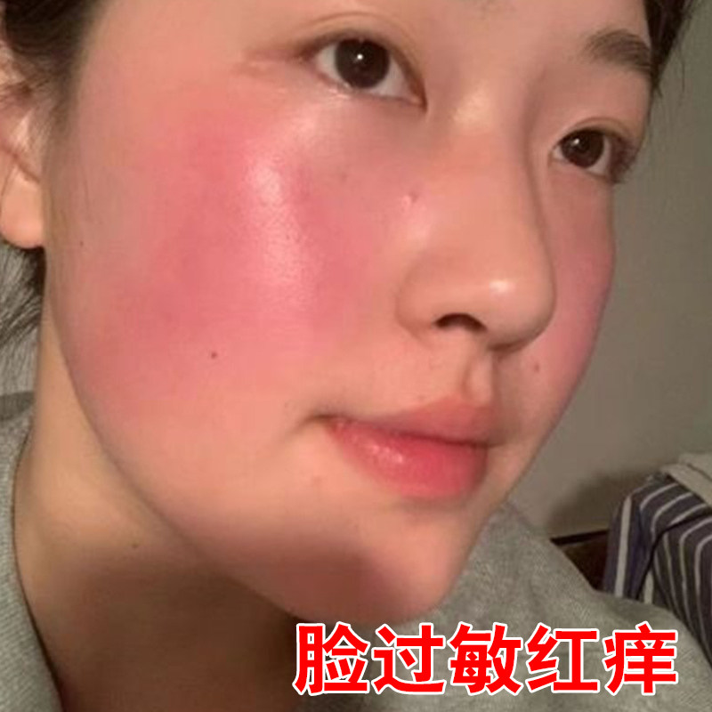 脸红发烫发热一热脸红脸部泛红刺乳液/面霜