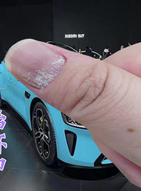 指甲黑色竖纹黑线手指甲真菌感染有竖纹指甲凹凸不平去指甲黑线膏