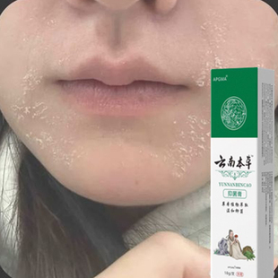 脸部干皮脸干起皮脸上起皮脱皮脸干痒爆皮季节性皮肤干燥粗糙滋润