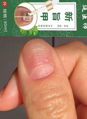 手指甲竖纹指甲黑色竖纹黑线指甲真菌感染手指甲修护膏专冶黑竖纹
