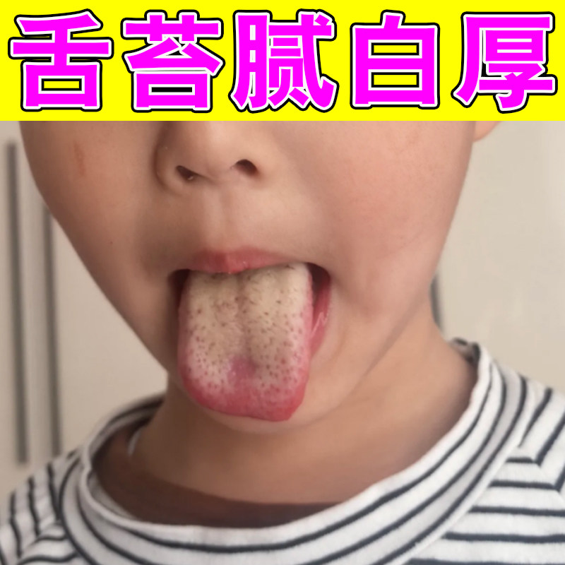 舌苔厚白厚黄腻调理脾胃除口臭去皮肤消毒护理（消）