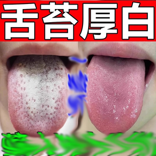 舌苔白厚口臭调理肠脾胃健湿气肝火口干苦舌头裂纹有齿痕喷雾剂药