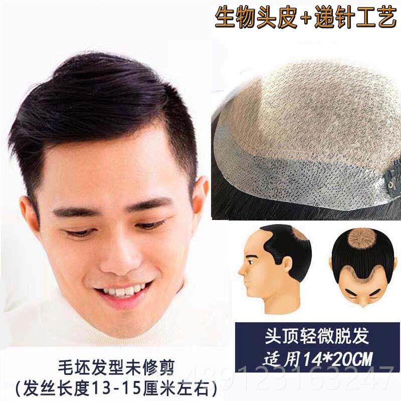 正品发假发男头顶补真男短发帅气织发发补发片男士秃顶前额发际线