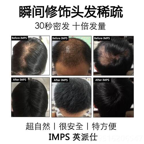 高档IMPS发际线填充浓密增多美发发补神器增发发假发密粉头发少纤