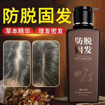 【明星推荐】黛青丝防脱洗发露固发密发控油去屑止痒改善毛躁滋养