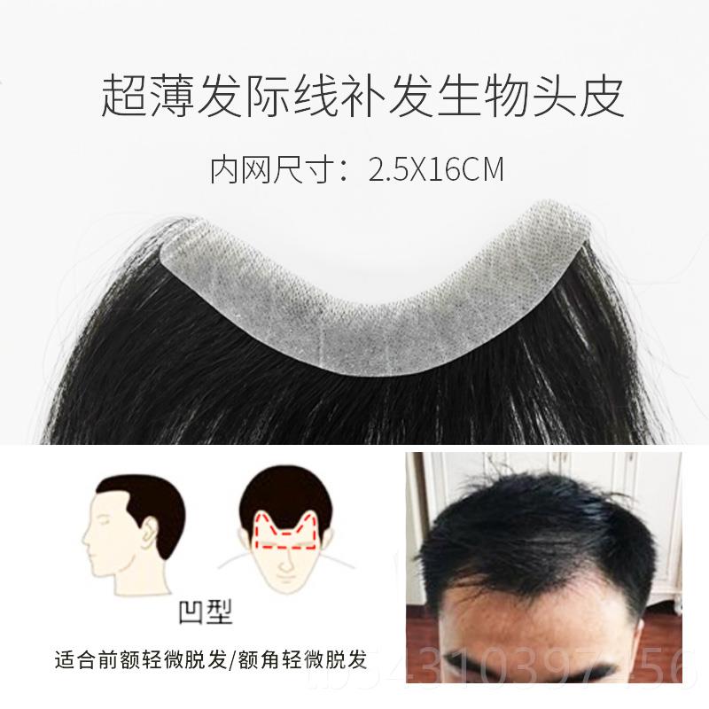 正品男士额发际线假发贴隐假刘海前额m型刘海生物头补皮发片形前