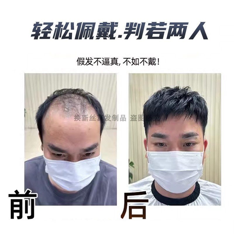 双递针假发男头顶真发中老y年短直发光头全头套隐形补发片