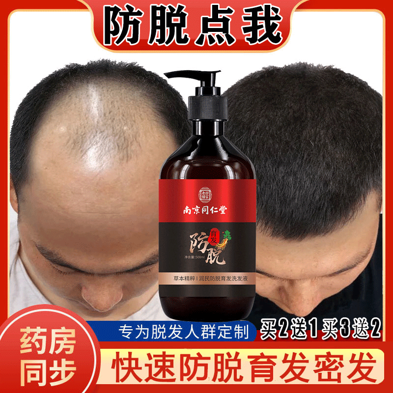 千朵草木洗发水防脱育发固发控油蓬松去屑生发增发正品官方店
