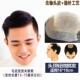 正品 年头顶补发真人发丝织补块秃补中 米尔补发男短发发顶假发男士
