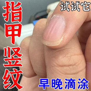 指甲竖纹营养不良凹凸不平指甲开裂萎缩空甲分层手指甲长黑线专用