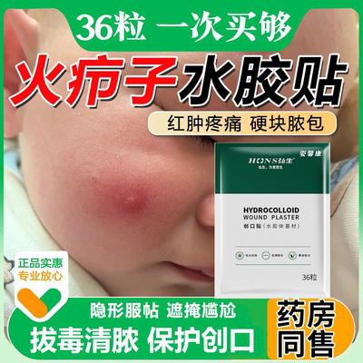 火疖子拔毒拔脓膏脸上粉