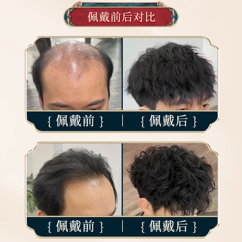 假发男短发全真发烫发造型头顶y补发片自然遮秃帅气时尚男款假发