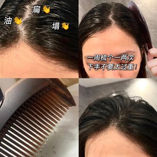 油头真的爱第三代能量梳免洗头按摩梳女士梳头家用气囊梳子去油脂