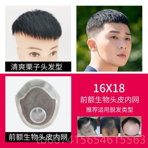 正品假发男韩额版帅气片头顶补发男无隐形假发片前真发痕际线生物