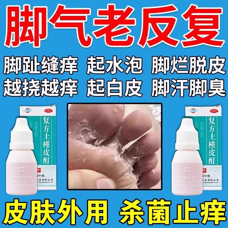 复方土槿皮酊男女脚气瘙痒股藓脚汗脚臭脚痒烂脚起水泡脱皮止痒i